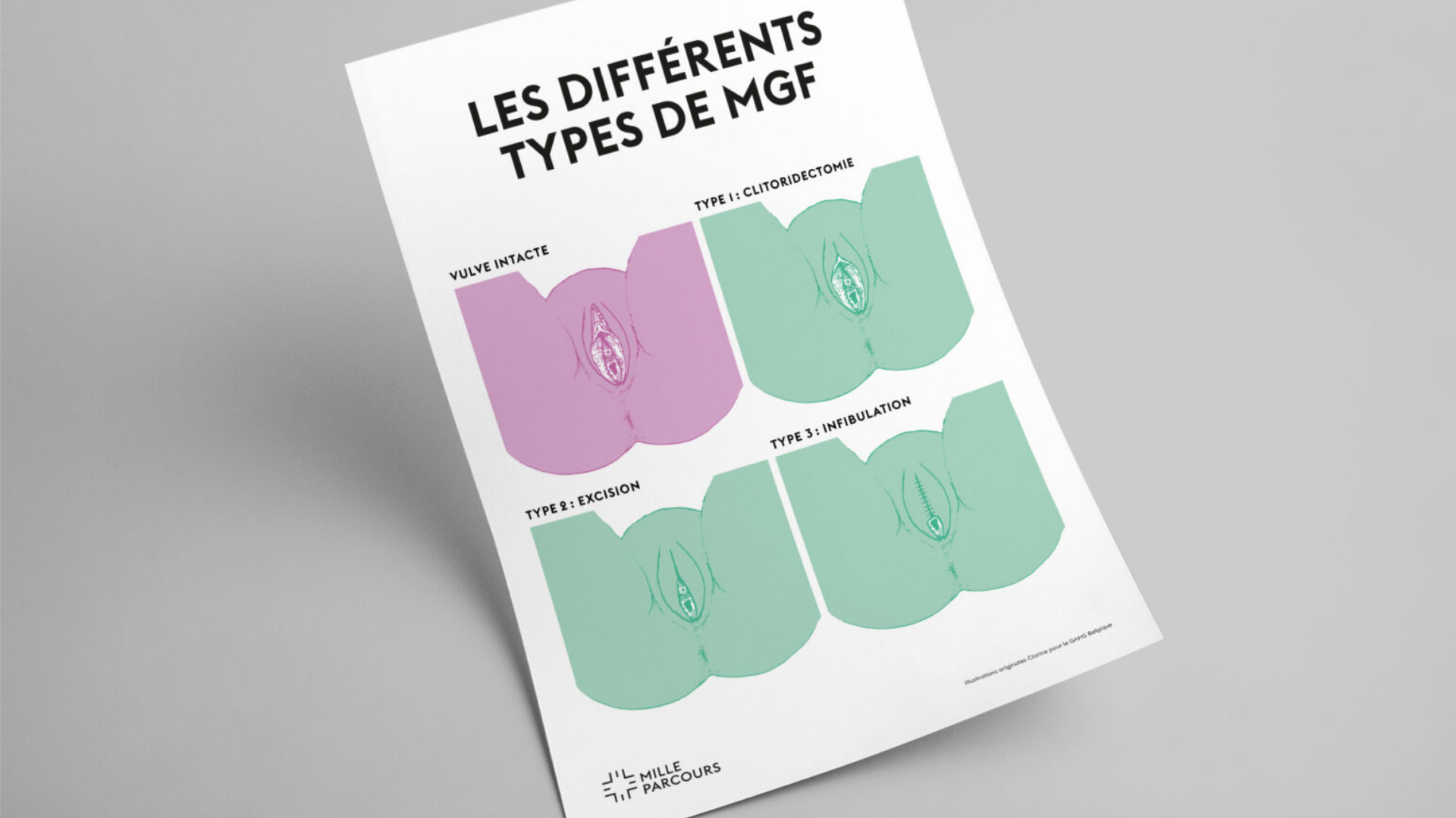 Image montrant les différents types de MGF